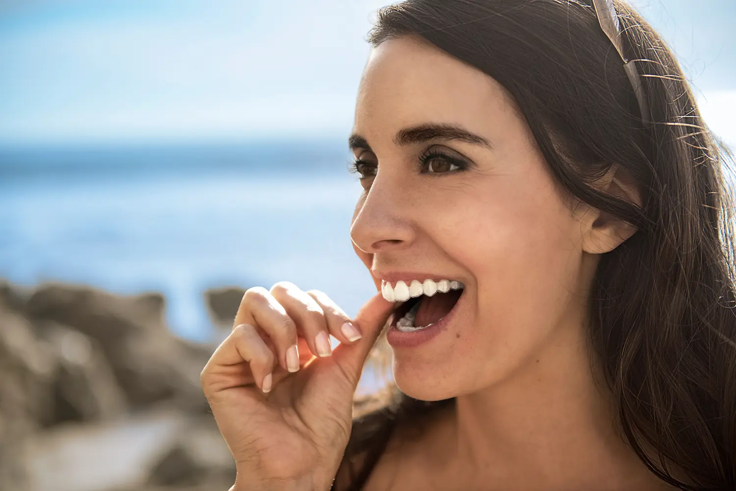 Invisalign